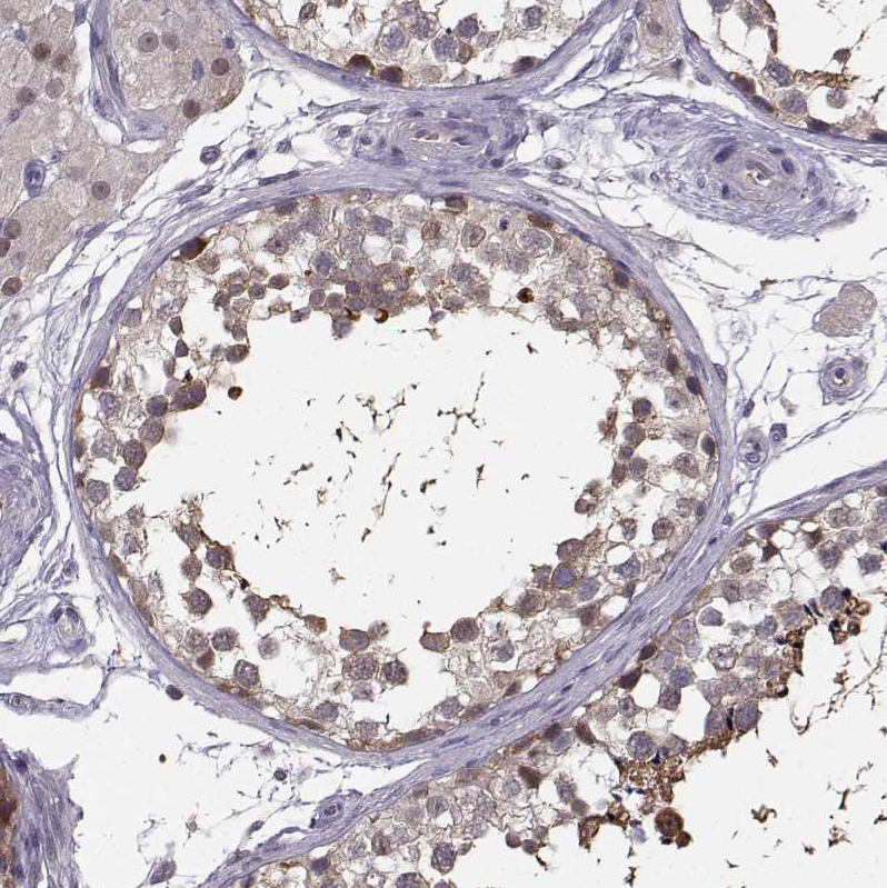 Immunohistochemistry (Formalin/PFA-fixed paraffin-embedded sections) - Anti-Plakophilin 2/PKP2 antibody (AB220840)