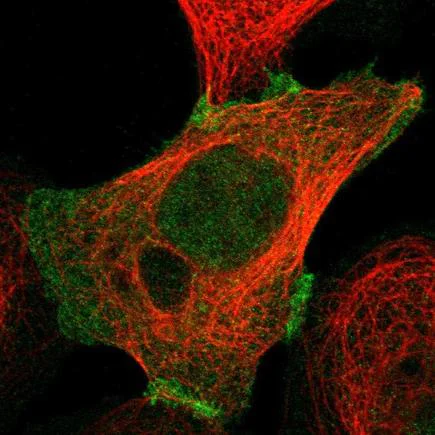 Immunocytochemistry/ Immunofluorescence - Anti-Plakophilin 2/PKP2 antibody (AB223757)