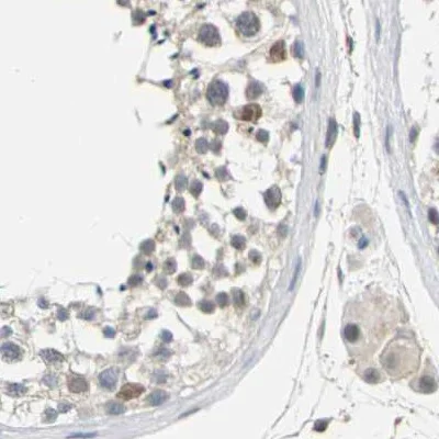 Immunohistochemistry (Formalin/PFA-fixed paraffin-embedded sections) - Anti-Plakophilin 2/PKP2 antibody (AB223757)