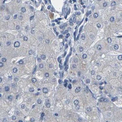 Immunohistochemistry (Formalin/PFA-fixed paraffin-embedded sections) - Anti-Plakophilin 2/PKP2 antibody (AB223757)