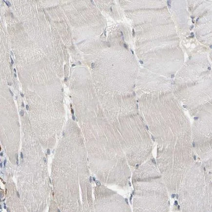 Immunohistochemistry (Formalin/PFA-fixed paraffin-embedded sections) - Anti-Plakophilin 2/PKP2 antibody (AB223757)