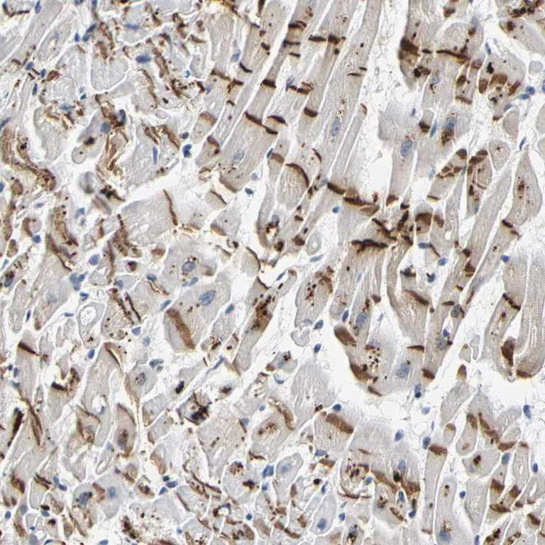 Immunohistochemistry (Formalin/PFA-fixed paraffin-embedded sections) - Anti-Plakophilin 2/PKP2 antibody (AB223757)