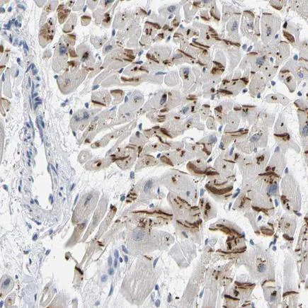 Immunohistochemistry (Formalin/PFA-fixed paraffin-embedded sections) - Anti-Plakophilin 2/PKP2 antibody (AB223757)