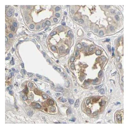 Immunohistochemistry (Formalin/PFA-fixed paraffin-embedded sections) - Anti-Plakophilin 2/PKP2 antibody (AB223757)