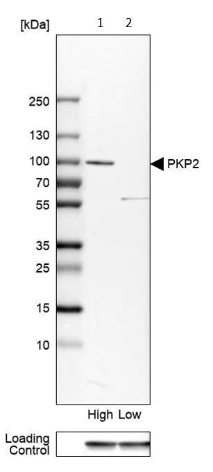 Western blot - Anti-Plakophilin 2/PKP2 antibody (AB223757)