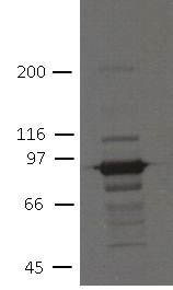 Western blot - Anti-Plakophilin 3 antibody [7F6] (AB151401), expandable thumbnail
