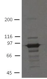 Western blot - Anti-Plakophilin 3 antibody [7F6] (AB151401)