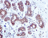 Immunohistochemistry (Formalin/PFA-fixed paraffin-embedded sections) - Anti-Plakophilin 3 antibody [EPR5560] (AB109441)