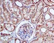 Immunohistochemistry (Formalin/PFA-fixed paraffin-embedded sections) - Anti-Plakophilin 3 antibody [EPR5560] (AB109441)