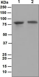 Western blot - Anti-Plakophilin 3 antibody [EPR5560] (AB109441)