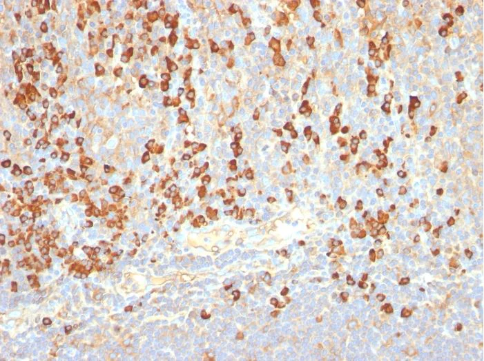 Immunohistochemistry (Formalin/PFA-fixed paraffin-embedded sections) - Anti-Plasma Cell antibody [LIV3G11] (AB270730)