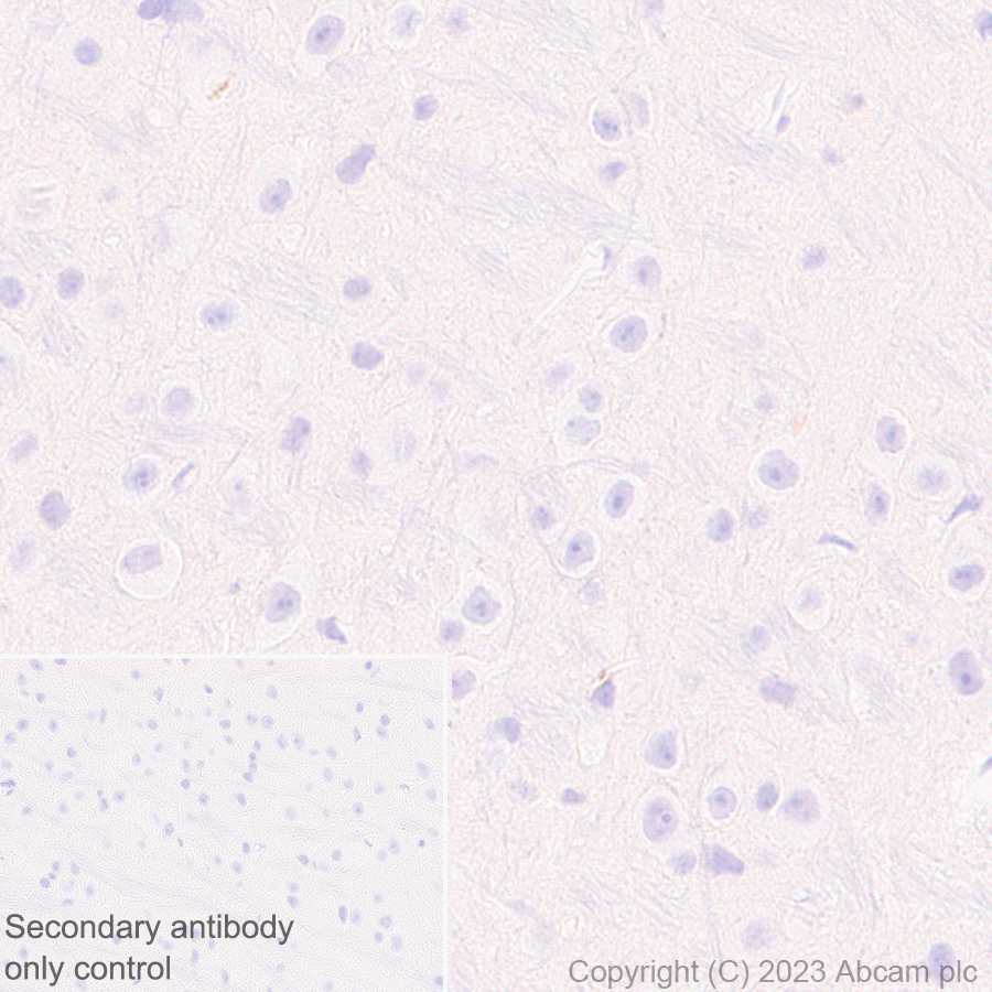 Immunohistochemistry (Formalin/PFA-fixed paraffin-embedded sections) - Anti-Plasma Kallikrein 1B antibody [EPR28280-31] - BSA and Azide free (ab313892), expandable thumbnail