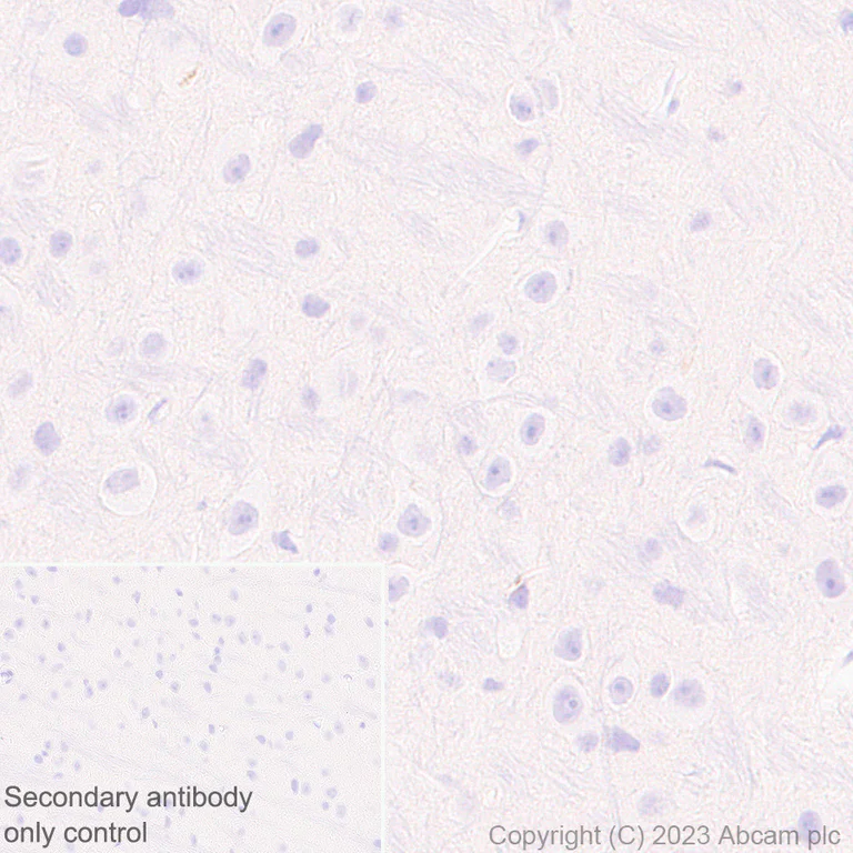 Immunohistochemistry (Formalin/PFA-fixed paraffin-embedded sections) - Anti-Plasma Kallikrein 1B antibody [EPR28280-31] - BSA and Azide free (AB313892)