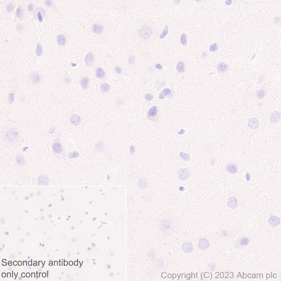 Immunohistochemistry (Formalin/PFA-fixed paraffin-embedded sections) - Anti-Plasma Kallikrein 1B antibody [EPR28280-31] - BSA and Azide free (ab313892), expandable thumbnail