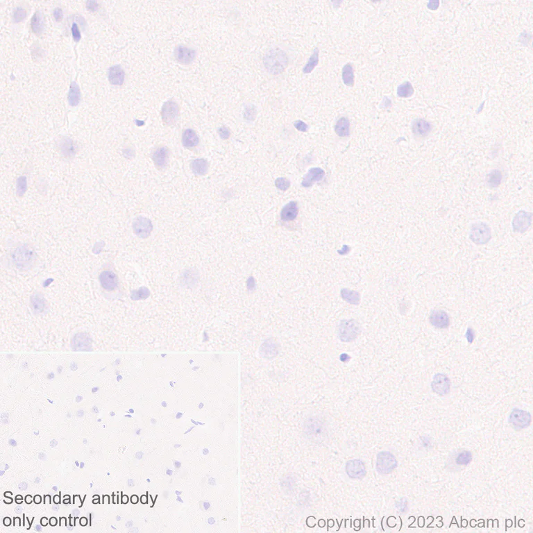 Immunohistochemistry (Formalin/PFA-fixed paraffin-embedded sections) - Anti-Plasma Kallikrein 1B antibody [EPR28280-31] - BSA and Azide free (AB313892)