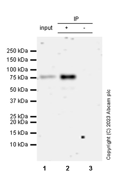 Immunoprecipitation - Anti-Plasma Kallikrein 1B antibody [EPR28280-31] - BSA and Azide free (AB313892), expandable thumbnail