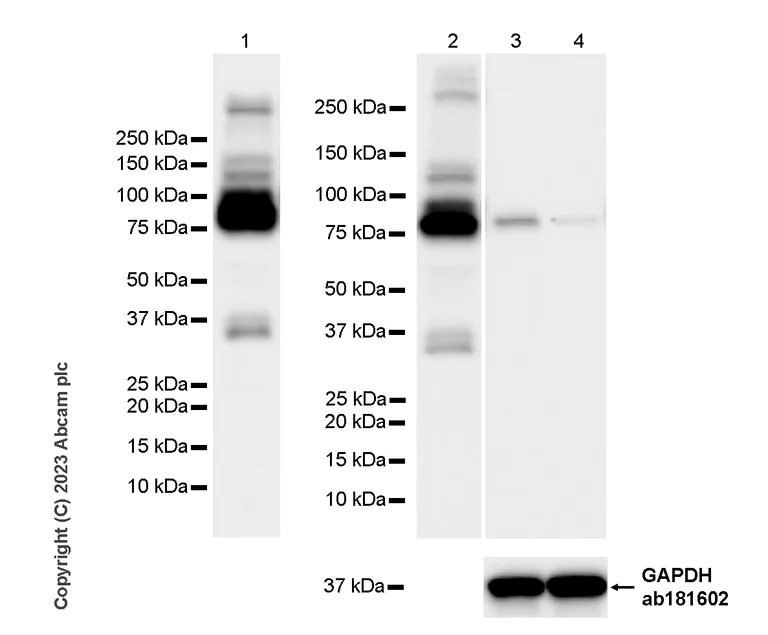 Western blot - Anti-Plasma Kallikrein 1B antibody [EPR28280-31] - BSA and Azide free (AB313892)