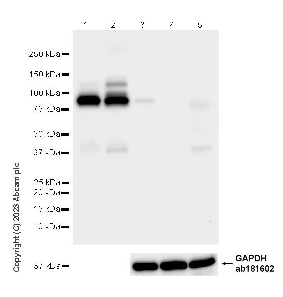 Western blot - Anti-Plasma Kallikrein 1B antibody [EPR28280-31] - BSA and Azide free (AB313892)