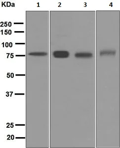 Western blot - Anti-Plasma Kallikrein 1B antibody [EPR5707] (AB124938)