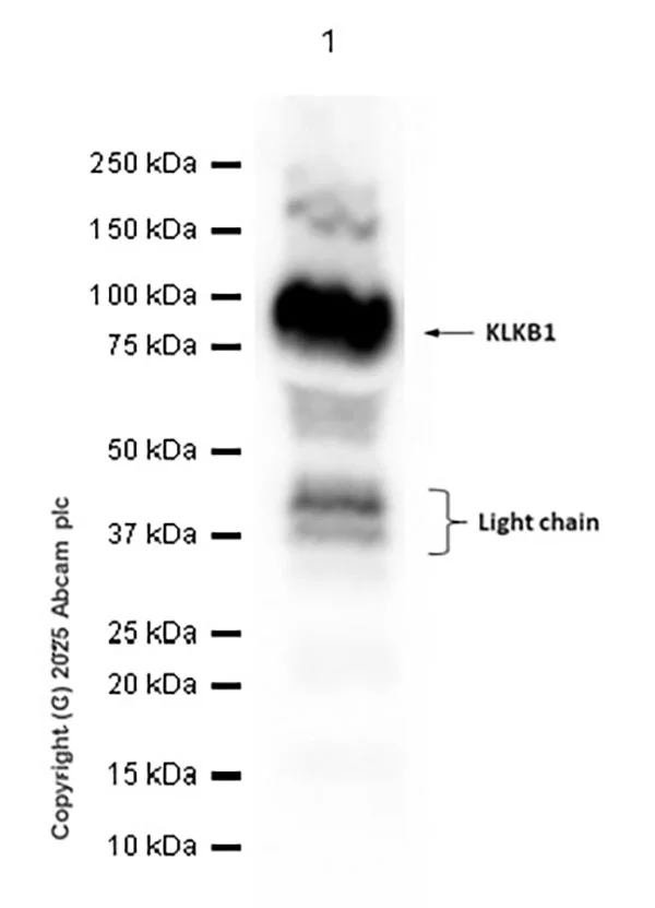 Western blot - Anti-Plasma Kallikrein 1B antibody [EPR5707] (AB124938)
