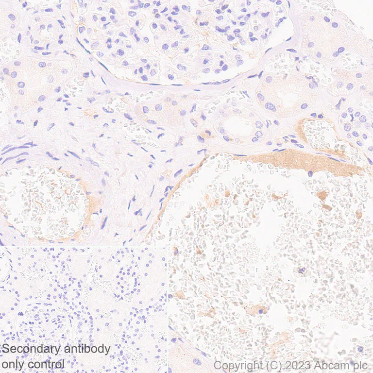 Immunohistochemistry (Formalin/PFA-fixed paraffin-embedded sections) - Anti-Plasma Kallikrein 1B antibody [RM2034] (AB315396)
