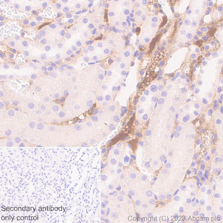 Immunohistochemistry (Formalin/PFA-fixed paraffin-embedded sections) - Anti-Plasma Kallikrein 1B antibody [RM2034] (AB315396)
