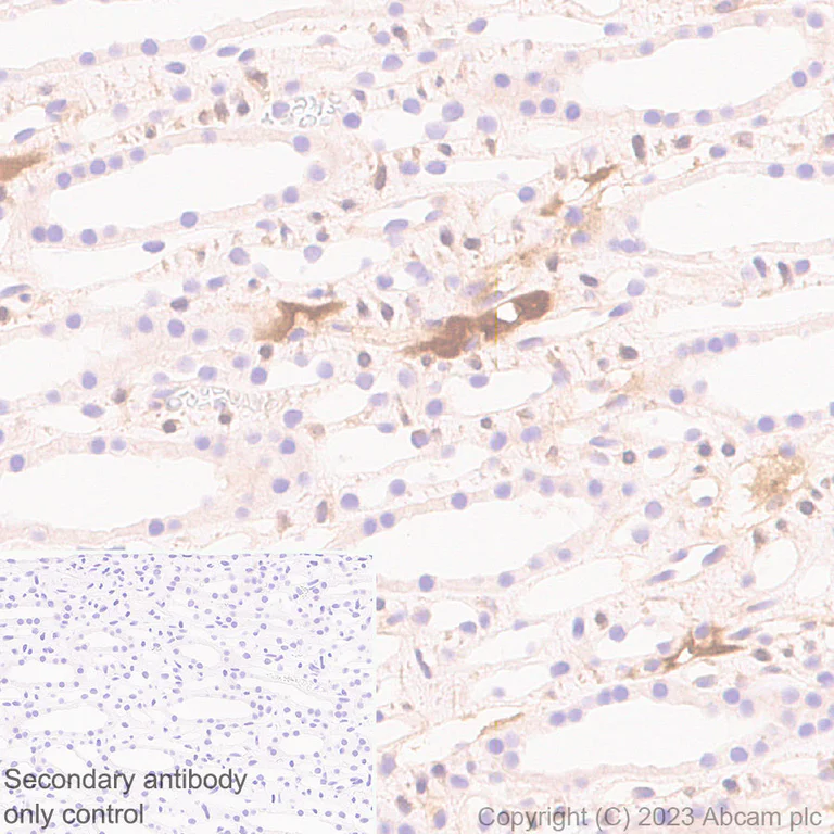 Immunohistochemistry (Formalin/PFA-fixed paraffin-embedded sections) - Anti-Plasma Kallikrein 1B antibody [RM2034] (AB315396)