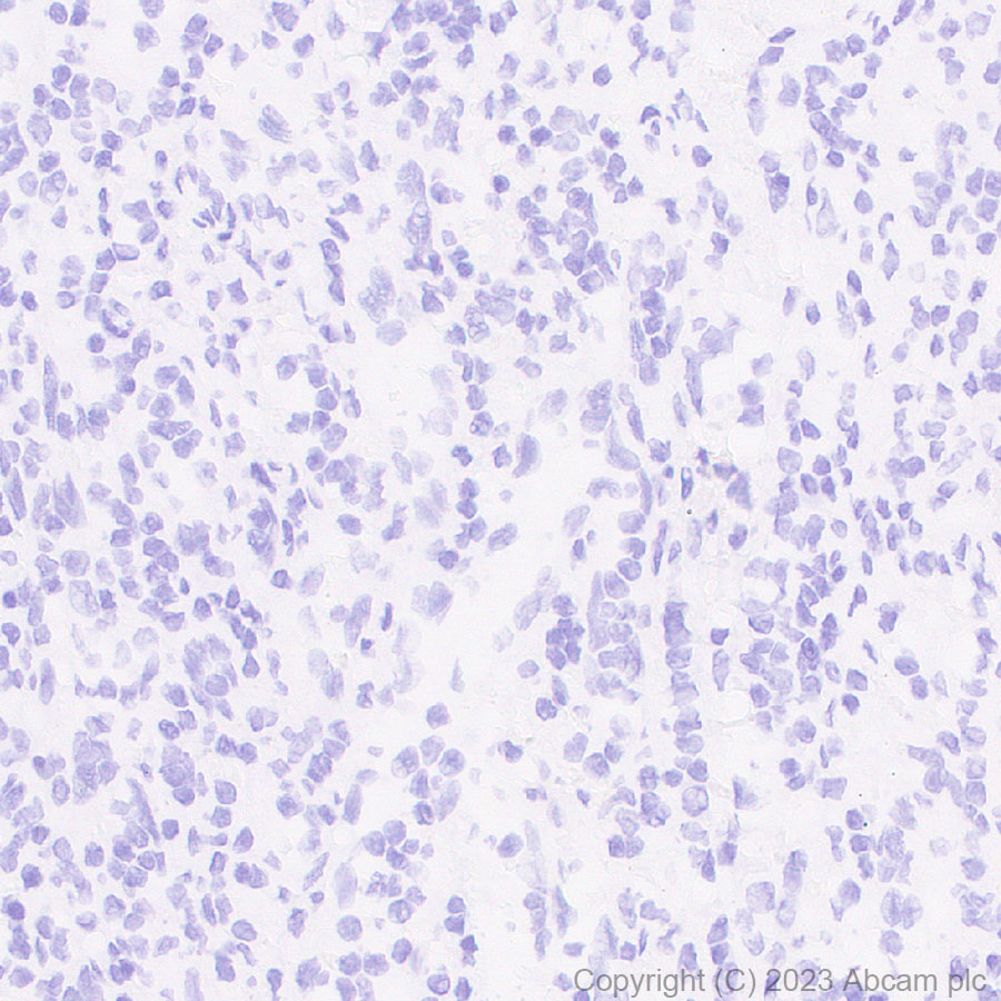 Immunohistochemistry (Formalin/PFA-fixed paraffin-embedded sections) - Anti-Plasma Kallikrein 1B antibody [RM2034] (AB315396)