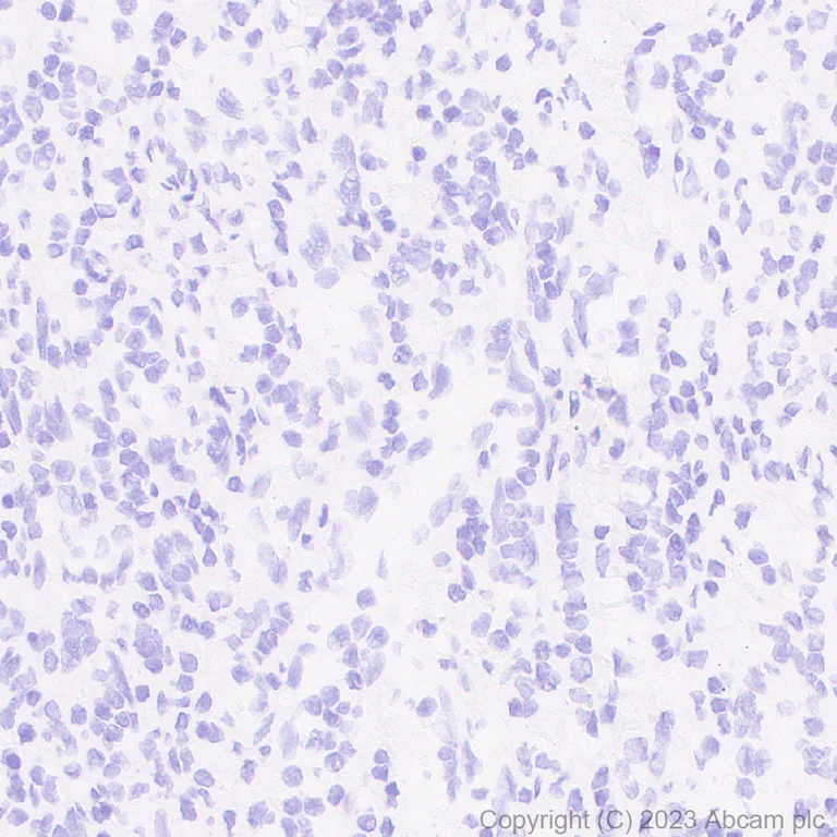 Immunohistochemistry (Formalin/PFA-fixed paraffin-embedded sections) - Anti-Plasma Kallikrein 1B antibody [RM2034] (AB315396)