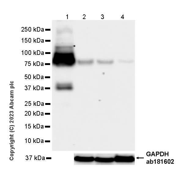 Western blot - Anti-Plasma Kallikrein 1B antibody [RM2034] (AB315396)