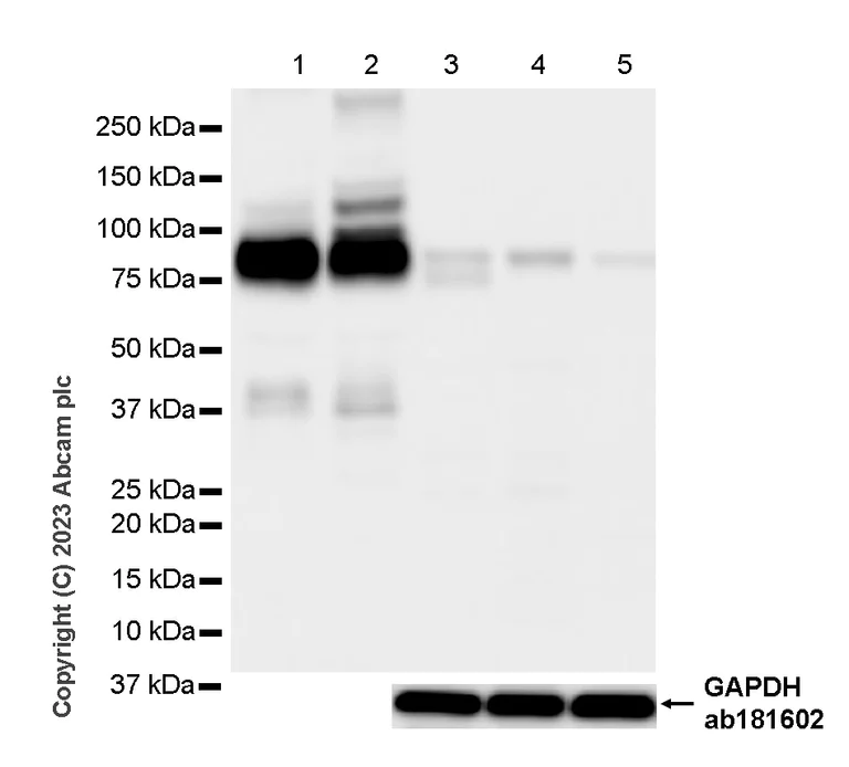 Western blot - Anti-Plasma Kallikrein 1B antibody [RM2034] (AB315396)