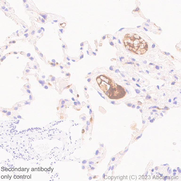 Immunohistochemistry (Formalin/PFA-fixed paraffin-embedded sections) - Anti-Plasma Kallikrein 1B antibody [RM2034] - BSA and Azide free (AB315397)