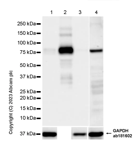 Western blot - Anti-Plasma Kallikrein 1B antibody [RM2034] - BSA and Azide free (AB315397)