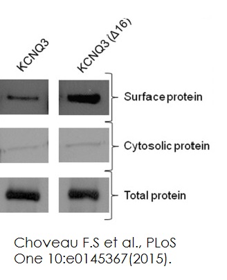 Western blot - Plasma Membrane Protein Extraction Kit (AB65400), expandable thumbnail