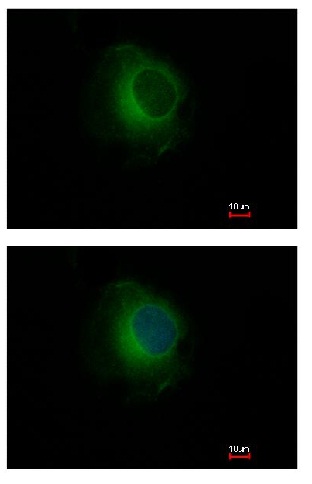 Immunocytochemistry/ Immunofluorescence - Anti-Plasminogen antibody (AB154560), expandable thumbnail