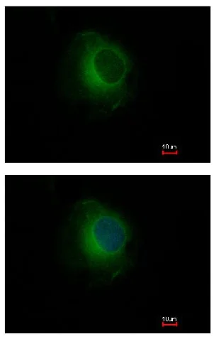 Immunocytochemistry/ Immunofluorescence - Anti-Plasminogen antibody (AB154560)
