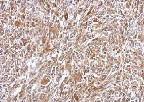 Immunohistochemistry (Formalin/PFA-fixed paraffin-embedded sections) - Anti-Plasminogen antibody (ab154560), expandable thumbnail