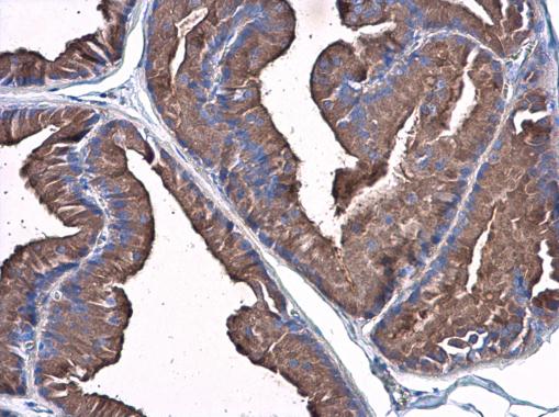 Immunohistochemistry (Formalin/PFA-fixed paraffin-embedded sections) - Anti-Plasminogen antibody (AB154560), expandable thumbnail
