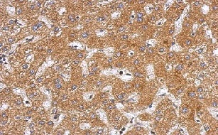 Immunohistochemistry (Formalin/PFA-fixed paraffin-embedded sections) - Anti-Plasminogen antibody (ab154560), expandable thumbnail