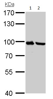 Western blot - Anti-Plasminogen antibody (AB154560), expandable thumbnail