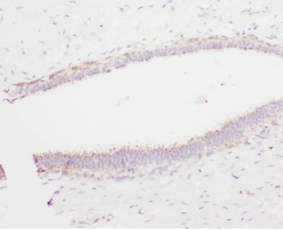 Immunohistochemistry (Formalin/PFA-fixed paraffin-embedded sections) - Anti-Plasminogen antibody (AB180046)