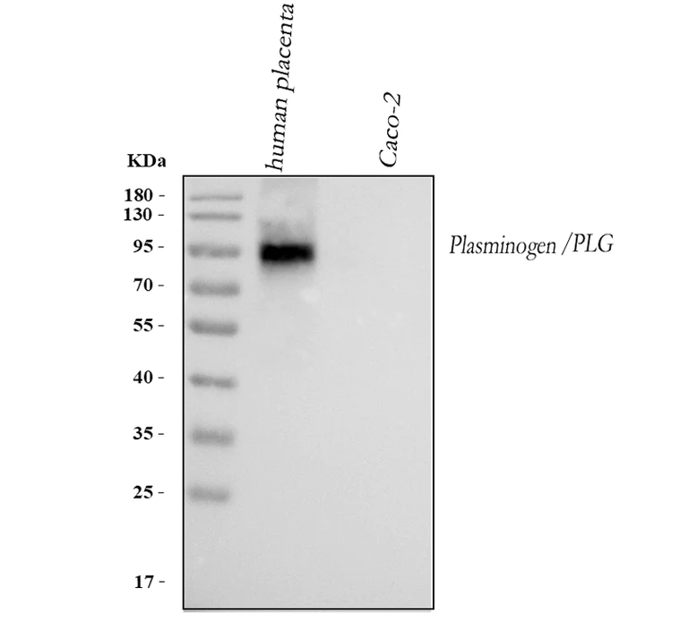 Western blot - Anti-Plasminogen antibody (AB180046)
