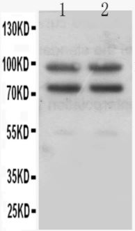 Western blot - Anti-Plasminogen antibody (AB180046)