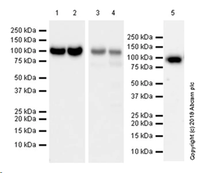 Western blot - Anti-Plasminogen antibody [EPR22254-115] (AB242329)