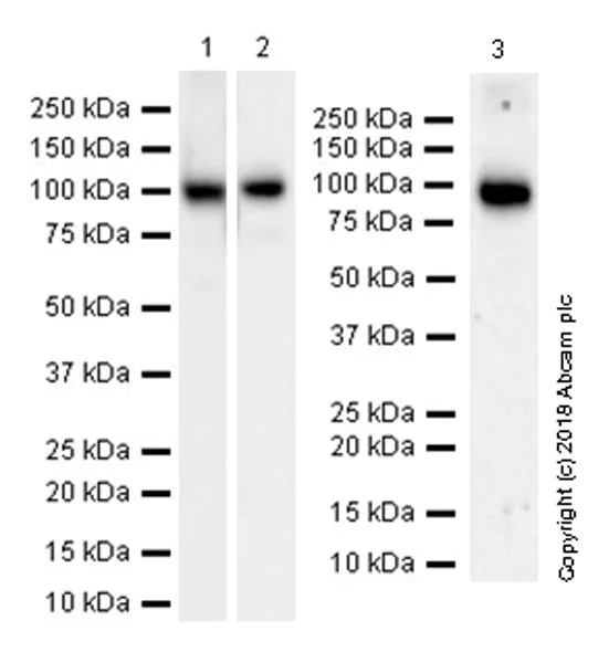 Western blot - Anti-Plasminogen antibody [EPR22406-159] (AB245247)