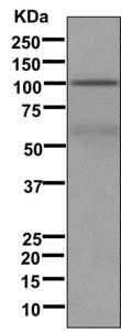 Western blot - Anti-Plasminogen antibody [EPSISR18(2)] (AB174285), expandable thumbnail