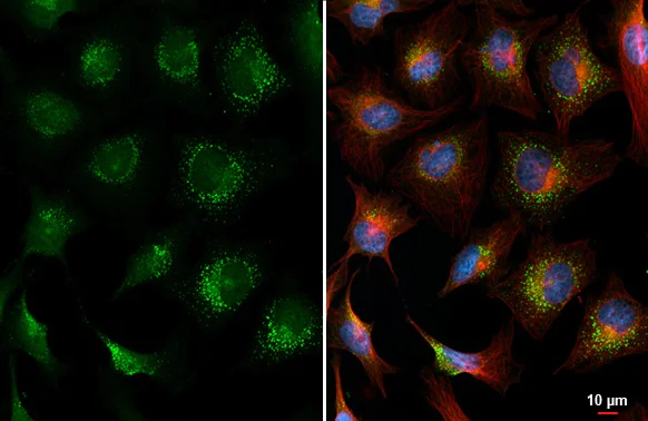 Immunocytochemistry/ Immunofluorescence - Anti-Plasminogen antibody [HL2071] (AB308224)