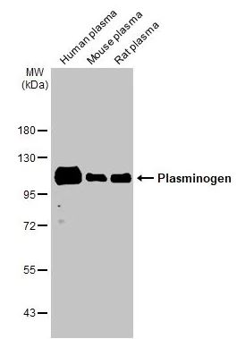 Western blot - Anti-Plasminogen antibody [HL2071] (ab308224), expandable thumbnail