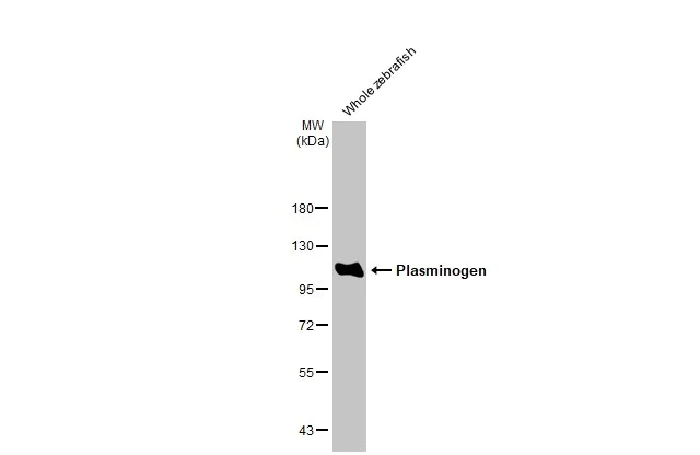 Western blot - Anti-Plasminogen antibody [HL2071] (AB308224)