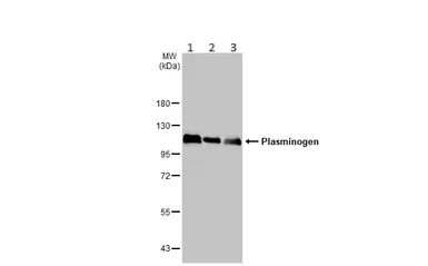 Western blot - Anti-Plasminogen antibody [HL2071] (AB308224), expandable thumbnail
